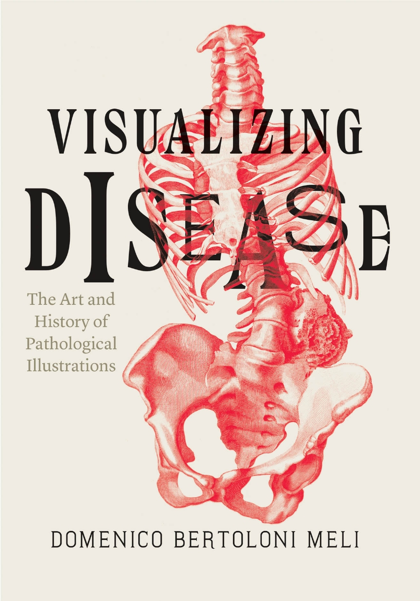 Visualizing Disease